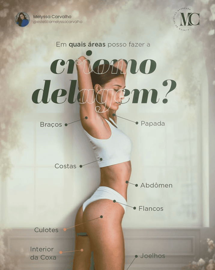 Post da MC mostrando as áreas do corpo onde a criomodelagem pode ser feita